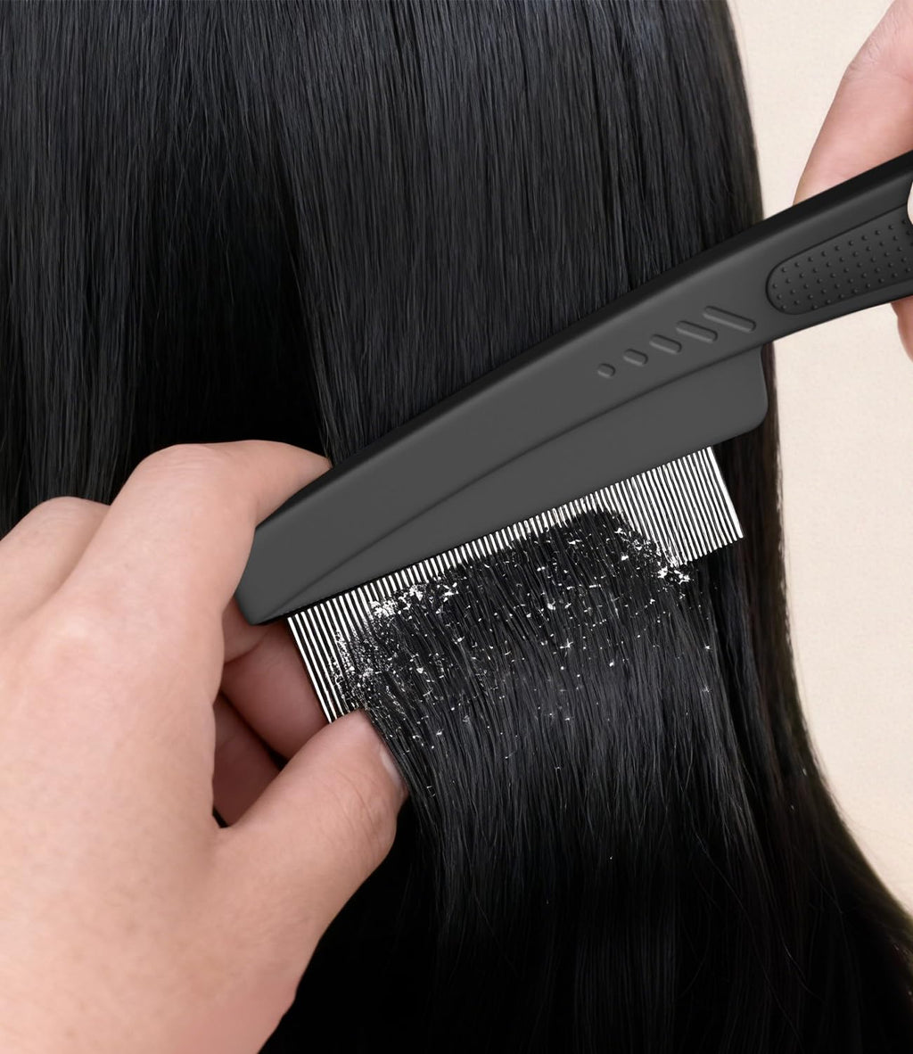 Dandruff Comb 2PC Upgraded Fine Tooth Scalp Detox Comb Lice for Women, Men & Kids Scalp Detoxing, Sweep & Massage Hair Brush Tool with Elegant Box for Hair Care